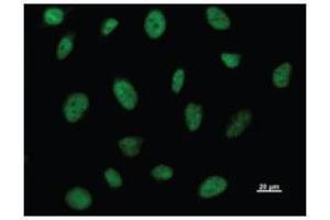 Immunostaining analysis in HeLa cells. (BRD3 Antikörper)