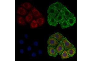 ABIN6257373 and ABIN6274770 staining HepG2 cells by IF/ICC. (RPL17 Antikörper  (C-Term))