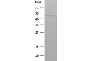 Western Blotting (WB) image for Septin 6 (SEPT6) (AA 1-434) protein (His tag) (ABIN7287175) (Septin 6 Protein (SEPT6) (AA 1-434) (His tag))