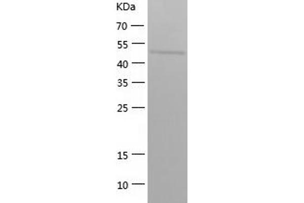 Septin 6 Protein (SEPT6) (AA 1-434) (His tag)