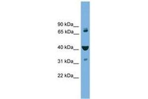 Image no. 1 for anti-Vacuolar Protein Sorting-Associated Protein 16 Homolog (VPS16) (C-Term) antibody (ABIN6745210) (VPS16 Antikörper  (C-Term))