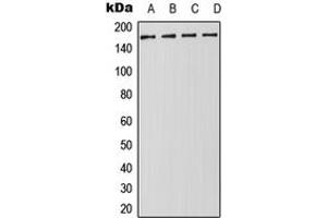 Western blot analysis of DROSHA expression in Jurkat (A), HeLa (B), NIH3T3 (C), PC12 (D) whole cell lysates. (DROSHA Antikörper  (Center))