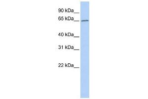 ACOT12 antibody used at 1 ug/ml to detect target protein. (ACOT12 Antikörper  (Middle Region))
