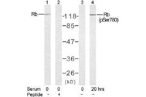 Image no. 2 for anti-Retinoblastoma 1 (RB1) (pSer780) antibody (ABIN196843) (Retinoblastoma 1 Antikörper  (pSer780))