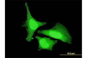 Immunofluorescence of monoclonal antibody to ZAK on HeLa cell. (ZAK Antikörper  (AA 1-120))