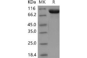 Western Blotting (WB) image for TEK Tyrosine Kinase, Endothelial (TEK) (Active) protein (His tag) (ABIN7198204) (TEK Protein (His tag))