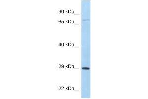 WB Suggested Anti-F11R Antibody Titration: 1. (F11R Antikörper  (C-Term))