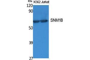 Western Blotting (WB) image for anti-DNA Cross-Link Repair 1B (DCLRE1B) (C-Term) antibody (ABIN3178096) (DCLRE1B Antikörper  (C-Term))
