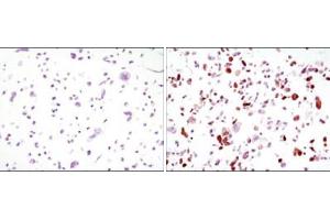 Immunohistochemistry (IHC) image for anti-Green Fluorescent Protein (GFP) antibody (ABIN1724673)