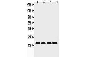 Anti-Cyclophilin B antibody, Western blotting Lane 1: Rat Ovary Tissue Lysate Lane 2: HELA Cell Lysate Lane 3: 293T Cell Lysate Lane 4: A431 Cell Lysate (PPIB Antikörper  (C-Term))
