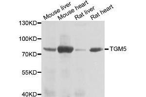 Western blot analysis of extracts of various cell lines, using TGM5 antibody. (Transglutaminase 5 Antikörper)