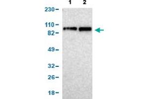 Western Blot analysis of (1) human cell line RT-4, and (2) human cell line U-251MG sp. (KIF2A Antikörper  (AA 35-144))