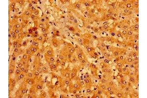 Immunohistochemistry of paraffin-embedded human liver tissue using ABIN7158957 at dilution of 1:100 (MCAT Antikörper  (AA 22-117))