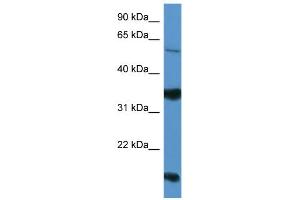 WB Suggested Anti-NTNG2 Antibody Titration: 0. (Netrin G2 Antikörper  (Middle Region))