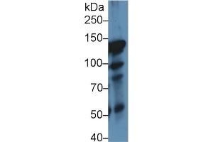 Detection of ITIH4 in Rat Lung lysate using Polyclonal Antibody to Inter Alpha-Globulin Inhibitor H4 (ITIH4) (ITIH4 Antikörper  (AA 478-722))