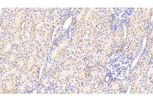 Immunohistochemistry (IHC) image for anti-Heparan Sulfate Proteoglycan 2 (HSPG2) (AA 4149-4391) antibody (ABIN7435115)