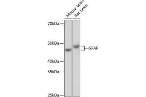 Western blot analysis of extracts of various cell lines, using GFAP antibody (ABIN7267389) at 1:1000 dilution. (GFAP Antikörper)
