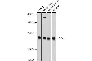 Western blot analysis of extracts of various cell lines, using GPX1 antibody (ABIN3021455, ABIN3021456, ABIN3021457, ABIN1512957 and ABIN6215063) at 1:1000 dilution. (Glutathione Peroxidase 1 Antikörper  (AA 50-203))