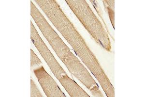 (ABIN652180 and ABIN2840585) staining hABCB10 in Human skeletal muscle tissue sections by Immunohistochemistry (IHC-P - paraformaldehyde-fixed, paraffin-embedded sections). (ABCB10 Antikörper  (N-Term))