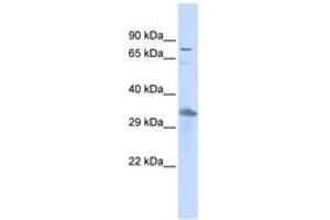 Image no. 1 for anti-Thyrotrophic Embryonic Factor (TEF) (AA 431-480) antibody (ABIN6742378) (TEF Antikörper  (AA 431-480))