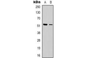 Western blot analysis of Dematin expression in Jurkat (A), HEK293T (B) whole cell lysates. (Dematin Antikörper  (C-Term))