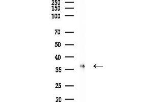 anti-Stearoyl-CoA Desaturase (Delta-9-Desaturase) (SCD) (pTyr55) antibody