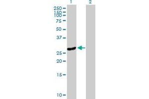 Western Blot analysis of DNAJC27 expression in transfected 293T cell line by DNAJC27 MaxPab polyclonal antibody. (DNAJC27 Antikörper  (AA 1-273))