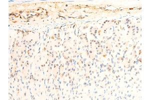 Immunohistochemistry (IHC) image for anti-Janus Kinase 1 (JAK1) (pTyr1022), (pTyr1023) antibody (ABIN6255762)