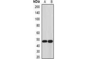 Western blot analysis of Hemojuvelin expression in Hela (A), PC3 (B) whole cell lysates. (HFE2 Antikörper)