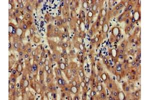 Immunohistochemistry of paraffin-embedded human liver tissue using ABIN7147124 at dilution of 1:100