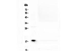 Western blot analysis of MAX using anti-MAX antibody . (MAX Antikörper  (AA 30-106))