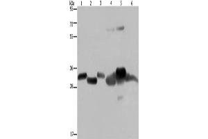Western Blotting (WB) image for anti-3-Hydroxymethyl-3-Methylglutaryl-CoA Lyase (HMGCL) antibody (ABIN2430231)
