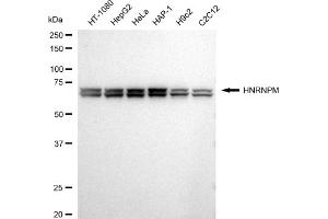 Western blotting analysis using HNRNPM antibody (ABIN7798901).