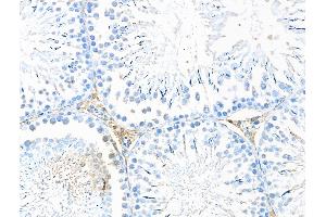 ABIN7094554 and ABIN7098603 at 1/100 staining Rat testis tissue by IHC-P. (DNASE2 Antikörper  (Internal Region))