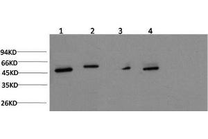 Western Blot analysis of Jurkat, Hela, Mouse brain, Rat brain using gamma Tubulin Monoclonal Antibody at dilution of 1:1000. (TUBG1 Antikörper)