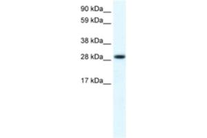 Western Blotting (WB) image for anti-Four and A Half LIM Domains 1 (FHL1) antibody (ABIN2460931) (FHL1 Antikörper)