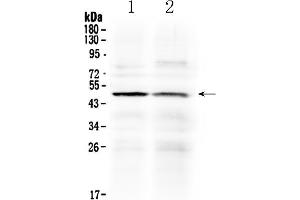 Western blot analysis of HtrA3 using anti- HtrA3 antibody . (HTRA3 Antikörper  (C-Term))