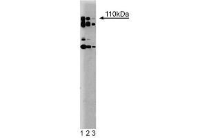 Western blot analysis of PI3-Kinase p110delta on a rat cerebrum lysate. (PIK3CD Antikörper  (AA 73-90))