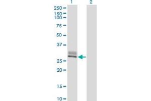 Western Blot analysis of SPINT2 expression in transfected 293T cell line by SPINT2 monoclonal antibody (M01), clone 2D1. (SPINT2 Antikörper  (AA 1-253))