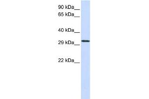 WB Suggested Anti-C21orf2 Antibody Titration:  0. (C21orf2 Antikörper  (N-Term))