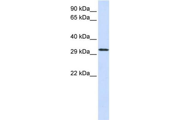 C21orf2 Antikörper  (N-Term)