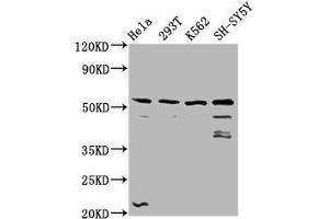 Western Blot Positive WB detected in: Hela whole cell lysate, 293T whole cell lysate, K562 whole cell lysate, SH-SY5Y whole cell lysate All lanes: RUFY3 antibody at 3. (RUFY3 Antikörper  (AA 243-352))