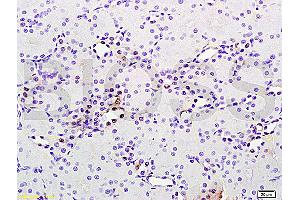 Formalin-fixed and paraffin embedded rat brain tissue labeled with Anti phospho-MAP3K9+MAP3K10(Thr312+Thr266) Polyclonal Antibody, Unconjugated (ABIN872294) at 1:200 followed by conjugation to the secondary antibody and DAB staining (MAP3K9 Antikörper  (pThr312))