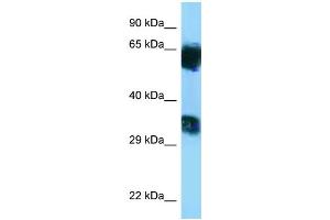 WB Suggested Anti-Mgat5b Antibody   Titration: 1.