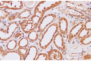 Immunohistochemistry of paraffin-embedded Human kidney using ITPKB Polyclonal Antibody at dilution of 1:200 (ITPKB Antikörper)