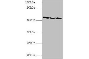 Western blot All lanes: USP14 antibody at 2 μg/mL Lane 1: Hela whole cell lysate Lane 2: 293T whole cell lysate Lane 3: NIH/3T3 whole cell lysate Secondary Goat polyclonal to rabbit IgG at 1/10000 dilution Predicted band size: 57, 53, 55 kDa Observed band size: 57 kDa (USP14 Antikörper  (C-Term))