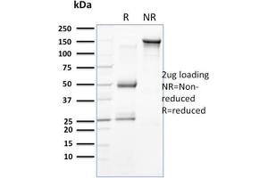 SDS-PAGE Analysis Purified Cytokeratin 15 Mouse Monoclonal Antibody (SPM190). (KRT15 Antikörper  (C-Term))