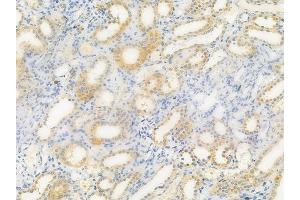 ABIN6257352 and ABIN6275243 at 1/100 staining human normal kidney tissue by IHC-P. (MRPL39 Antikörper  (C-Term))