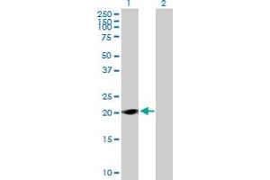 Western Blot analysis of LOC285697 expression in transfected 293T cell line by LOC285697 MaxPab polyclonal antibody. (TAF11L1 Antikörper  (AA 1-183))