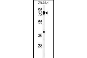 Western blot analysis of HAS1 Antibody in ZR-75-1 cell line lysates (35ug/lane) (HAS1 Antikörper  (AA 166-193))